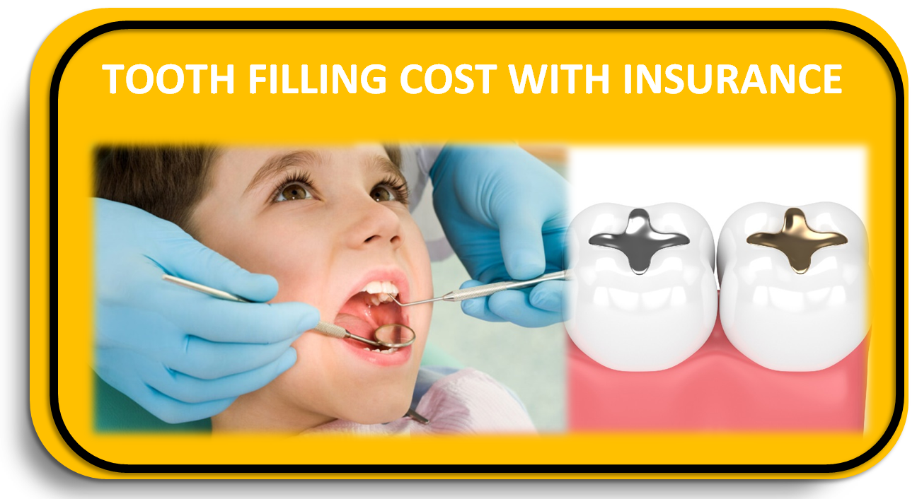 Tooth Filling Cost with Insurance