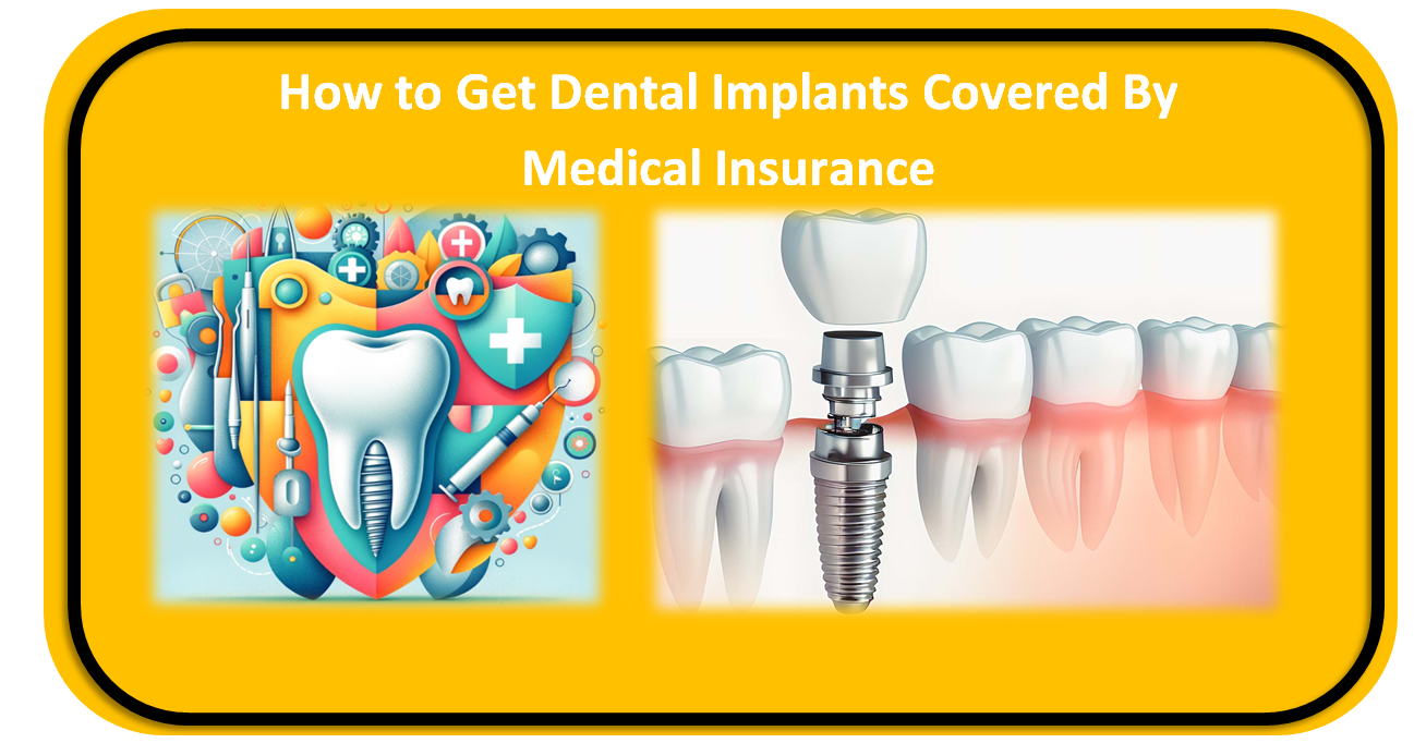 How to Get Dental Implants Covered By Medical Insurance
