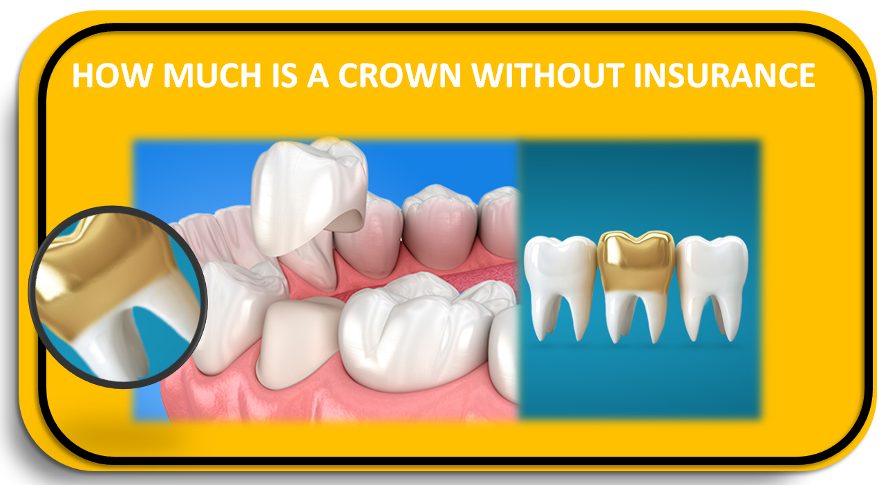 How Much is a Crown Without Insurance