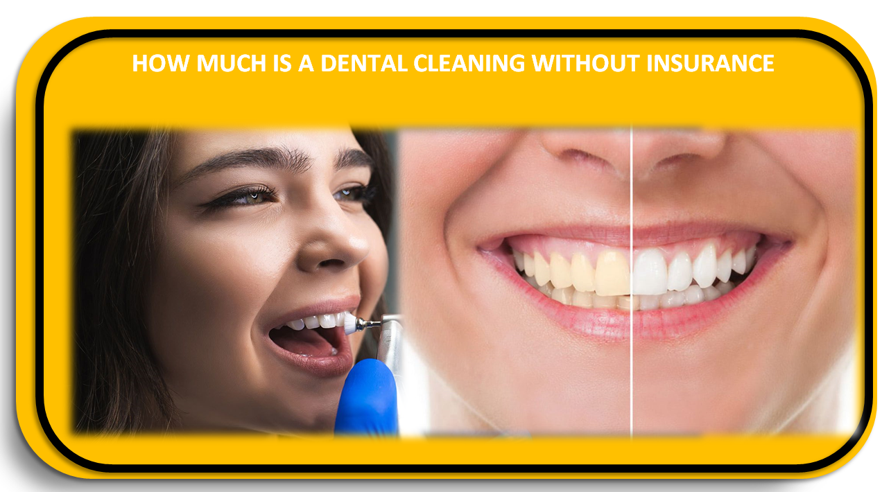 How much is a Dental Cleaning Without Insurance